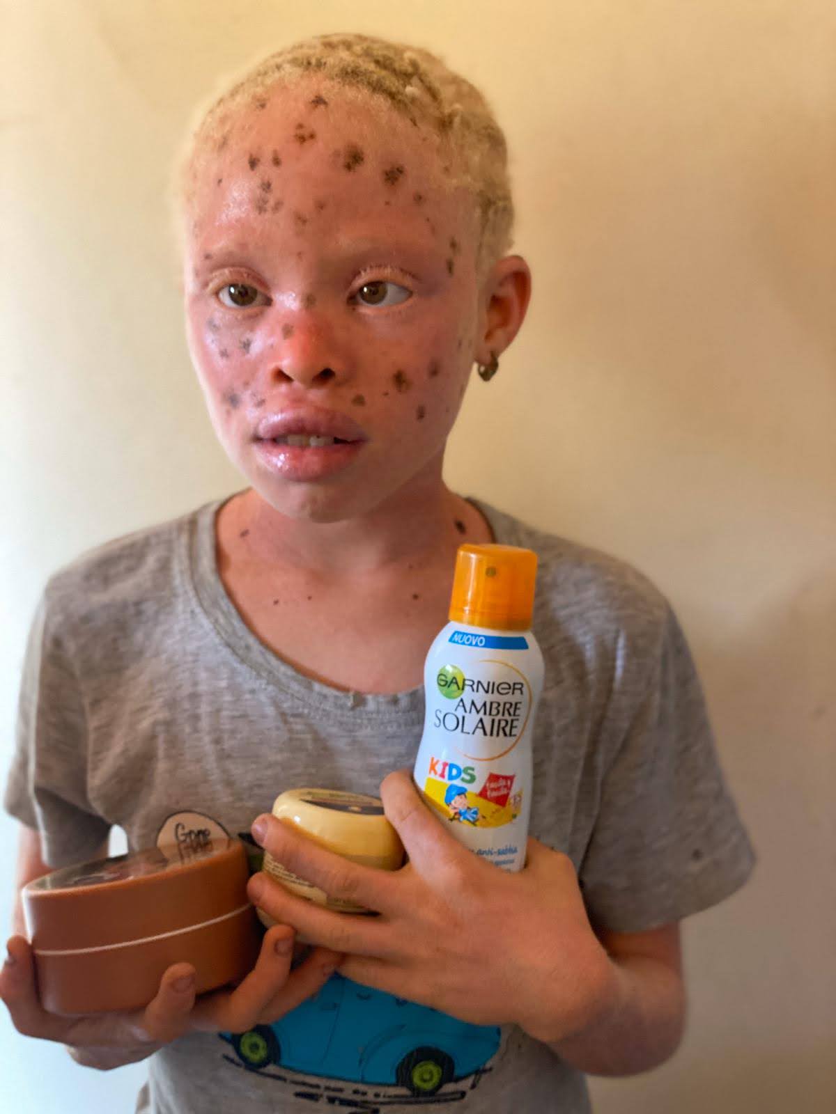 Santé et Protection